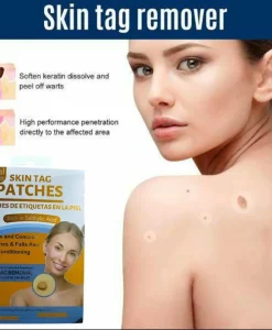 Skin Tag Remover Yellow Cotton 1 Pc
